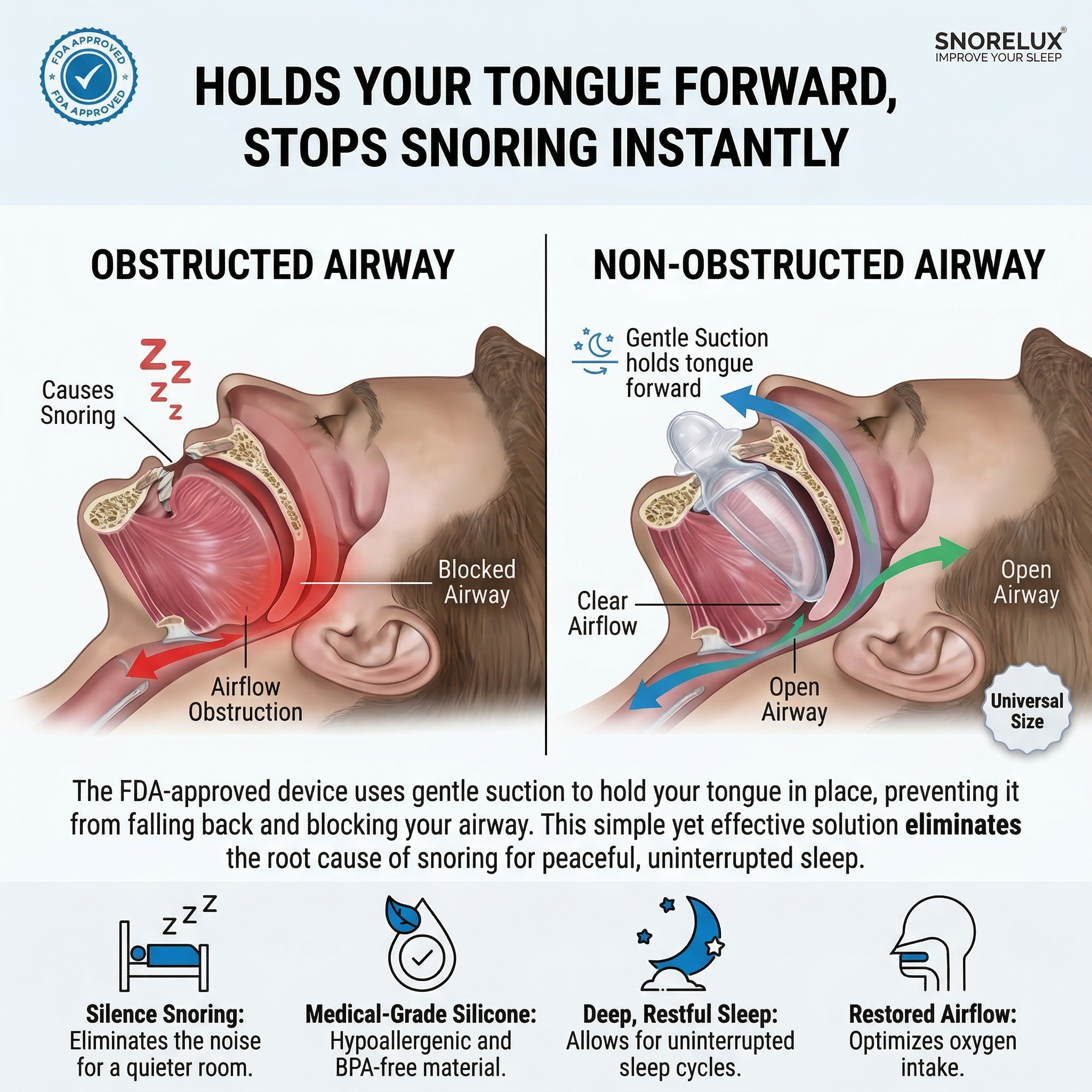 Anti-Snoring Tongue Device